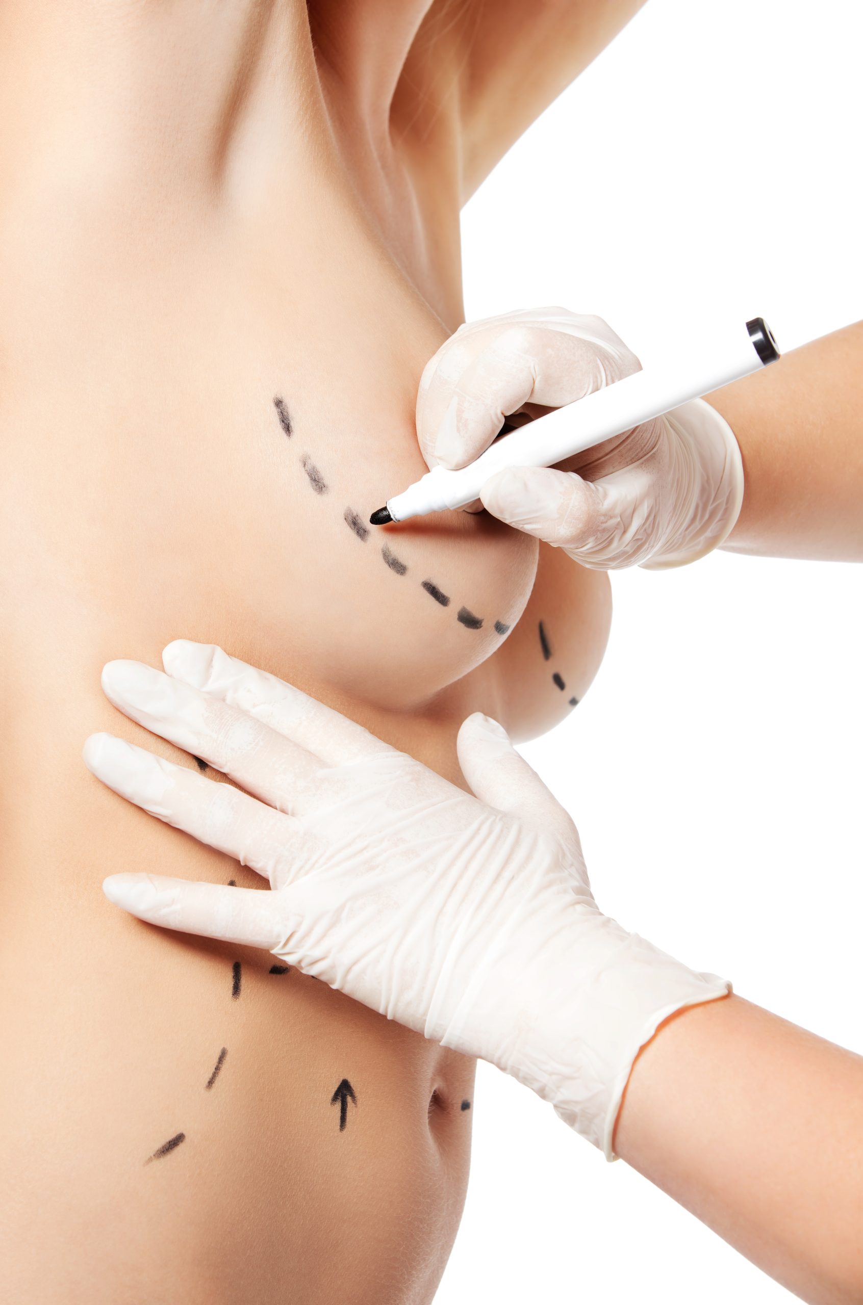 Segurança Jurídica e Técnica na Cirurgia Plástica: O Que o Paciente Precisa Saber Antes de Assinar Qualquer Documento